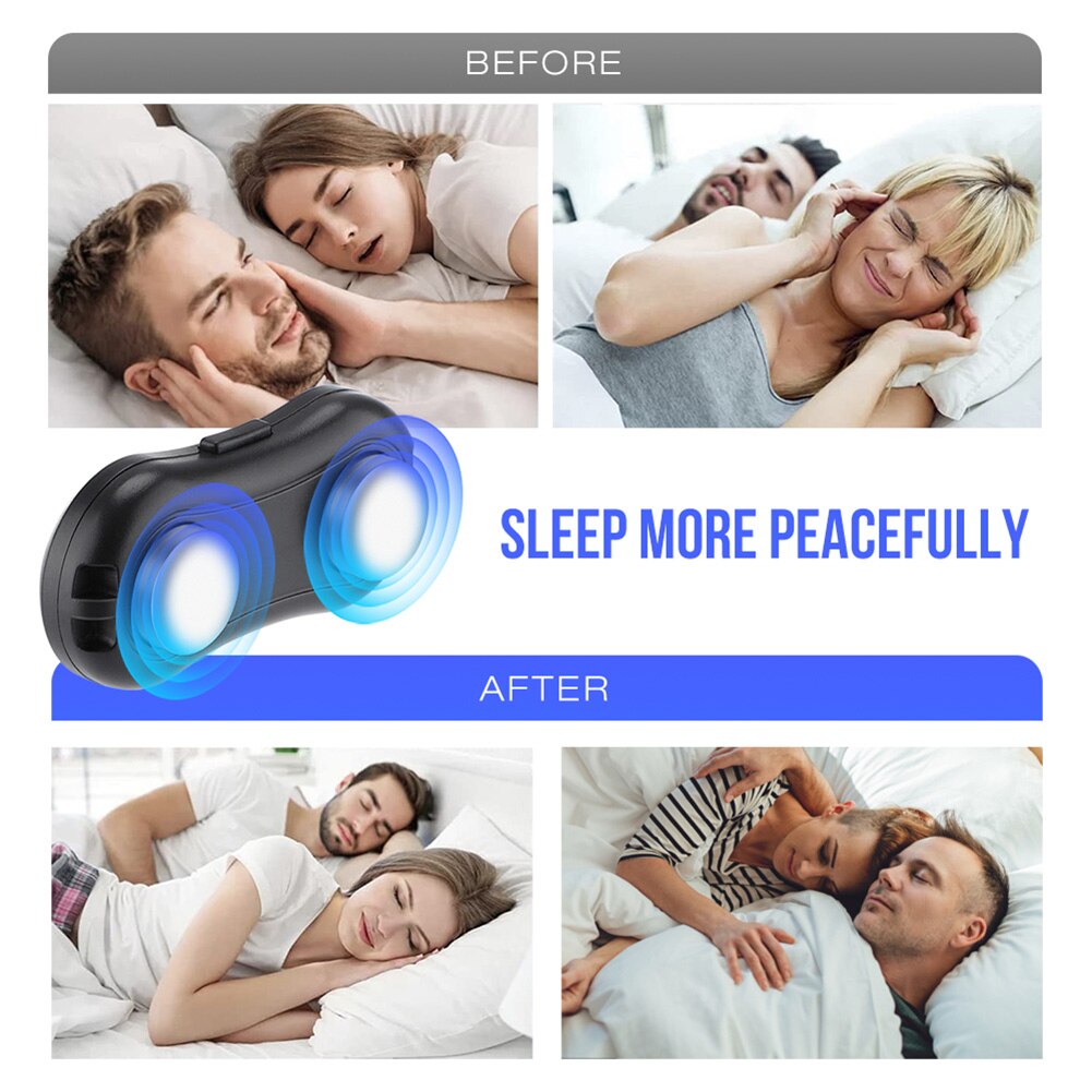 GoodsU™ Smart Anti Snoring Device