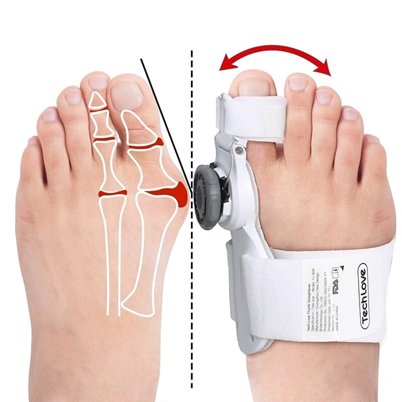 GoodsU™ Toe Brace